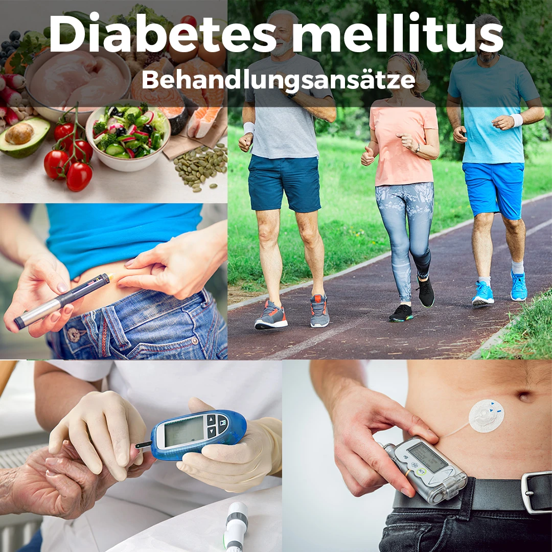 Bildcollage aus frischem Gemüse und Fisch, joggendem älteren Paar, Blutzuckermessung durch behandschuhte Hände und Insulinpumpe am Bauch – Säulen der Therapie